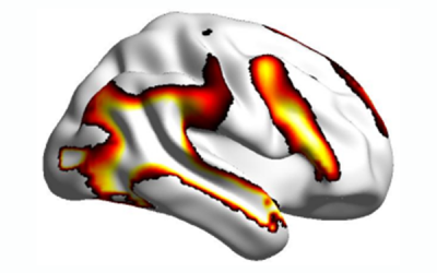 Autistic people’s social brain activity is not reduced
